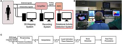 Real-Time Rotational Activity Detection in Atrial Fibrillation